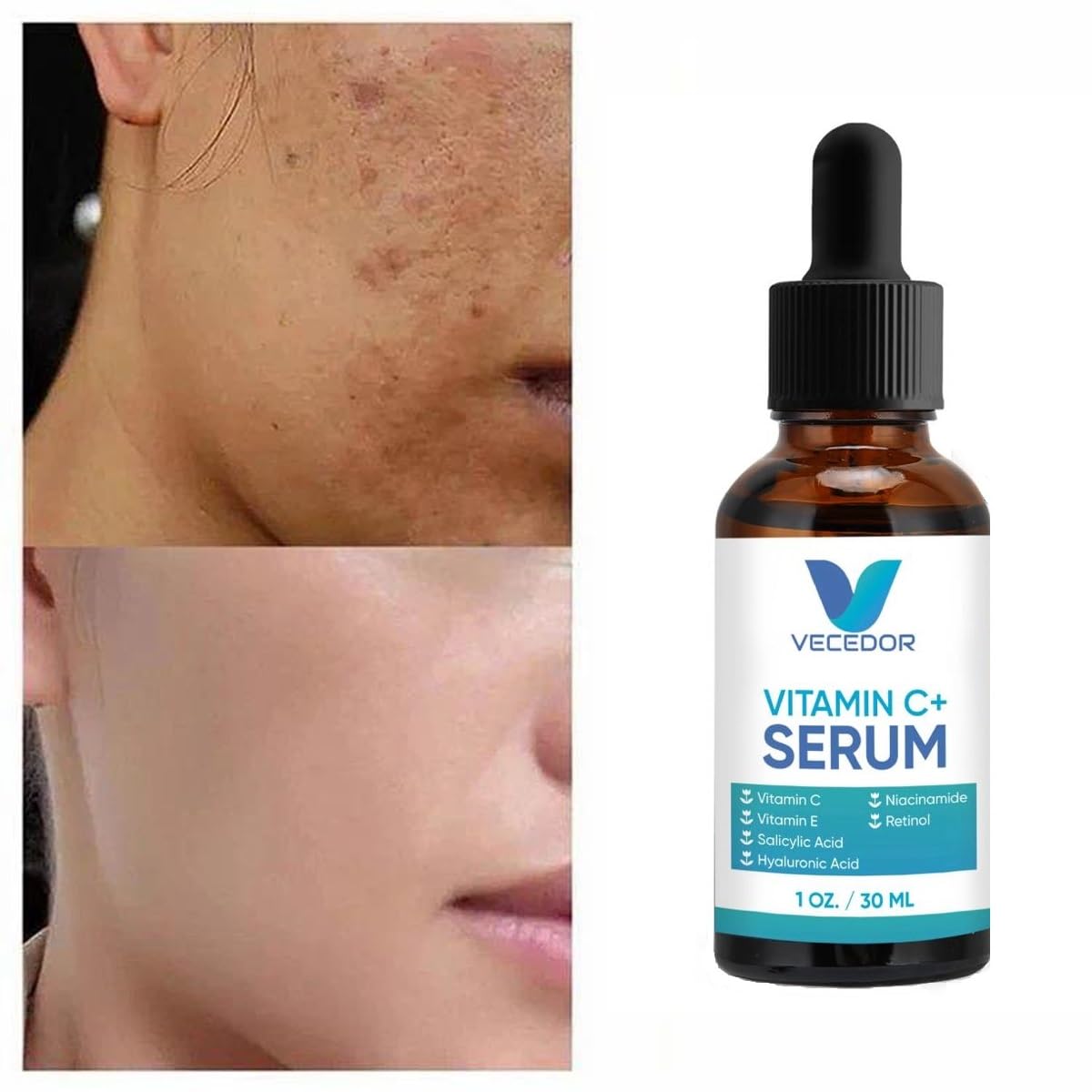 face serum