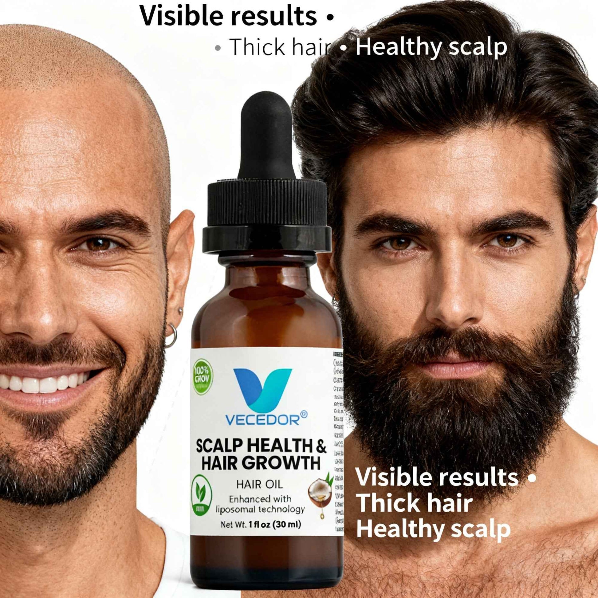 VECEDOR Hair Oil for Scalp Health and Hair Growth