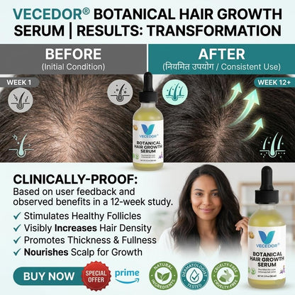 VECEDOR Botanical Hair Growth Serum– Nourishing Scalp Treatment for Thicker, Stronger & Healthier Hair  2 fl oz
