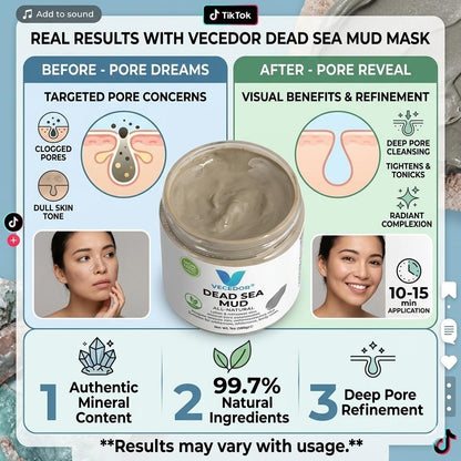VECEDOR Dead Sea Mud for Face & Body, Natural Mineral-Rich Mask for Deep Pore Cleansing and Oil Control, 7oz