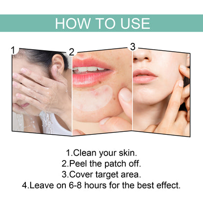 EELHOE Acne Relief Mask Patch Is A Gentle, Non-irritating Acne Mask That Helps To Reduce Acne Marks And Heal Acne.