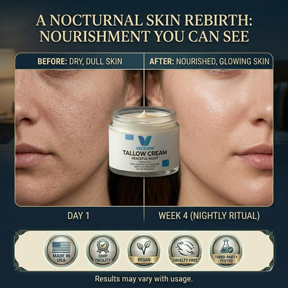 VECEDOR Tallow Cream Peaceful Night – Nourishing Night Cream for Dry & Sensitive Skin – Natural Moisturizing & Skin Repair, 2oz
